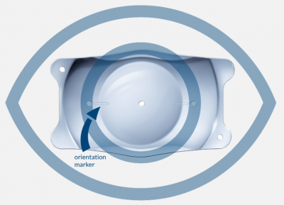 orientation-marker orientation-marker