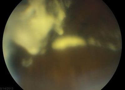 RLE-Judging-Posterior-Pole4