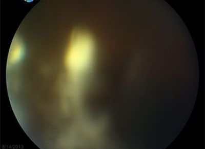 RLE-Judging-Posterior-Pole5